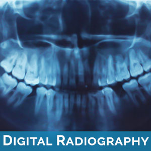 Digital Radiography in Ramona