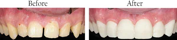 Poway dental images